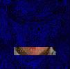 79